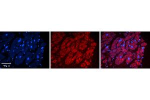 Rabbit Anti-ADAR Antibody   Formalin Fixed Paraffin Embedded Tissue: Human heart Tissue Observed Staining: Cytoplasmic Primary Antibody Concentration: N/A Other Working Concentrations: 1:600 Secondary Antibody: Donkey anti-Rabbit-Cy3 Secondary Antibody Concentration: 1:200 Magnification: 20X Exposure Time: 0. (ADAR Antikörper  (N-Term))