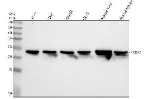 Western blot analysis of PRDX1/Peroxiredoxin 1 using anti-PRDX1/Peroxiredoxin 1 antibody (ABIN7606032).