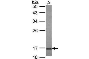 WB Image Sample (30 ug of whole cell lysate) A: Hela 10% SDS PAGE antibody diluted at 1:1000 (UBE2A Antikörper)