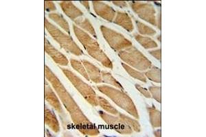 Immunohistochemistry (Paraffin-embedded Sections) (IHC (p)) image for anti-Immunoglobulin Superfamily Containing Leucine Rich Repeat Protein (ISLR) (AA 333-362), (C-Term) antibody (ABIN651071)