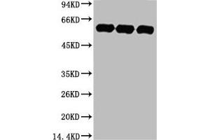 Western blot analysis of 1) Hela, 2) Rat BrianTissue, 3) Mouse Brain Tissue, diluted at 1:5000. (TUBA1A Antikörper)