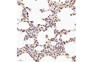 Immunohistochemistry of paraffin embedded rat lung using NSFL1C (ABIN7074865) at dilution of 1:700 (400x lens) (NSFL1C Antikörper)