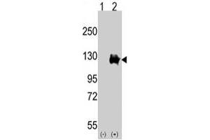 Western blot analysis of TRPM8 (arrow) using rabbit TRPM8 polyclonal antibody . (TRPM8 Antikörper  (AA 1075-1104))