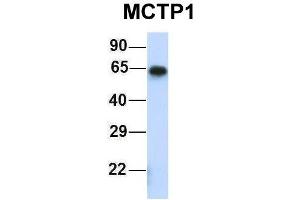 Host:  Rabbit  Target Name:  MCTP1  Sample Type:  Human Fetal Muscle  Antibody Dilution:  1. (MCTP1 Antikörper  (Middle Region))