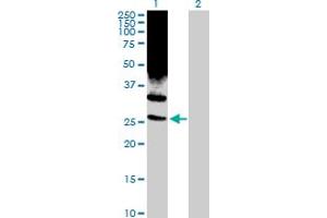 Western Blot analysis of PSMD10 expression in transfected 293T cell line by PSMD10 MaxPab rabbit polyclonal antibody. (PSMD10 Antikörper  (AA 1-226))