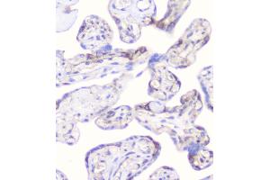 IHC analysis of CD2AP using anti-CD2AP antibody (ABIN6719544). (CD2AP Antikörper  (AA 253-337))