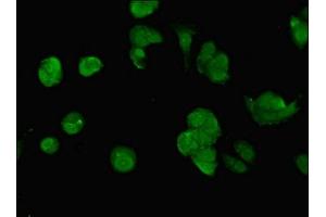 Immunofluorescent analysis of MCF-7 cells using ABIN7150297 at dilution of 1:100 and Alexa Fluor 488-congugated AffiniPure Goat Anti-Rabbit IgG(H+L) (SWI5 Antikörper  (AA 54-112))