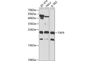 Western blot analysis of extracts of various cell lines, using T antibody (ABIN3015850, ABIN3015851, ABIN1682962 and ABIN6219191) at 1:1000 dilution. (TAF9 Antikörper  (AA 1-172))