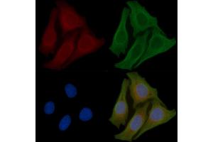ABIN6259493 and ABIN6274910 staining Hela cells(45 min of heat-shock) by IF/ICC.