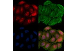 ABIN6256500 and ABIN6267669 staining Hela cells(20 min of 30uM Forskolin treatment) by IF/ICC.