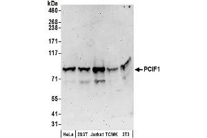 Western Blotting (WB) image for anti-PDX1 C-terminal Inhibiting Factor 1 (PCIF1) (AA 654-704) antibody (ABIN7449784)