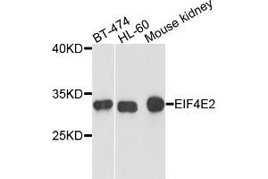 Western blot analysis of extracts of various cell lines, using EIF4E2 antibody. (EIF4E2 Antikörper)