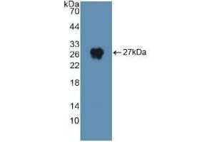 Detection of Recombinant DNM2, Human using Polyclonal Antibody to Dynamin 2 (DNM2)