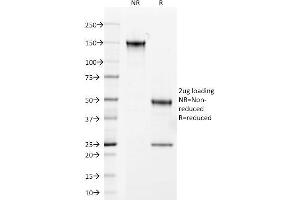 SDS-PAGE Analysis Purified Androgen Receptor Mouse Monoclonal Antibody (AR441). (Androgen Receptor Antikörper  (AA 302-318))
