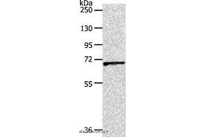 Western blot analysis of Human liver cancer tissue, using SLC22A3 Polyclonal Antibody at dilution of 1:600 (OCT4 Antikörper)