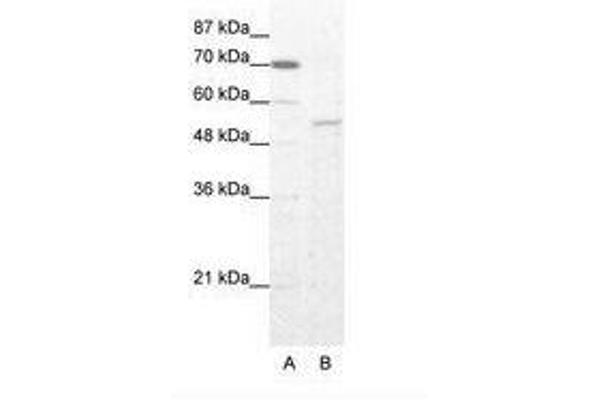 ZNF665 抗体  (AA 146-195)