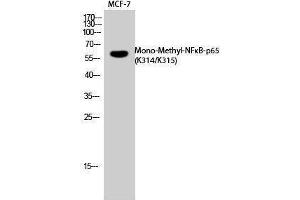 Western Blotting (WB) image for anti-Nuclear Factor-kB p65 (NFkBP65) (acLys314), (acLys315) antibody (ABIN3181858) (NF-kB p65 Antikörper  (acLys314, acLys315))