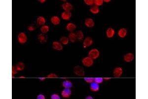 Immunofluorescence analysis of HeLa cells using CYP11B2 Polyclonal Antibody at dilution of 1:100 (40x lens). (CYP11B2 Antikörper)
