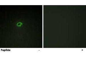 Immunofluorescence analysis of COS-7 cells, using COL4A4 polyclonal antibody . (Col4a4 Antikörper)