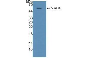 Detection of Recombinant CPR, Human using Polyclonal Antibody to Cytochrome P450 Reductase (CPR) (POR Antikörper  (AA 77-518))
