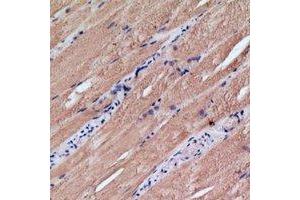 Immunohistochemical analysis of MRPS18C staining in human skeletal muscle formalin fixed paraffin embedded tissue section. (MRPS18C Antikörper)