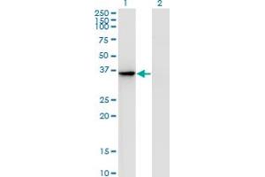 Western Blot analysis of AKR1D1 expression in transfected 293T cell line by AKR1D1 monoclonal antibody (M01), clone 1A6. (AKR1D1 Antikörper  (AA 227-326))