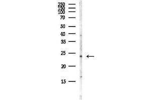 anti-Homeobox B6 (HOXB6) antibody