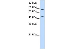 WB Suggested Anti-THOC1 Antibody Titration:  0.