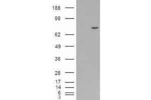 Image no. 2 for anti-Premelanosome Protein (PMEL) (C-Term) antibody (ABIN374704) (Melanoma gp100 Antikörper  (C-Term))