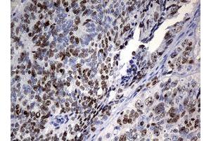 Image no. 2 for anti-Antigen Identified By Monoclonal Antibody Ki-67 (MKI67) (AA 1160-1493) antibody (ABIN1490857) (Ki-67 Antikörper  (AA 1160-1493))