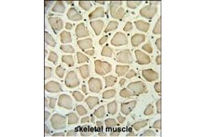 PGP Antibody (N-term) (ABIN653810 and ABIN2843085) IHC analysis in formalin fixed and paraffin embedded skeletal muscle followed by peroxidase conjugation of the secondary antibody and DAB staining.