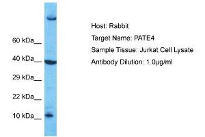 Host: Rabbit Target Name: PATE4 Sample Type: Jurkat Whole Cell lysates Antibody Dilution: 1. (PATE4 Antikörper  (Middle Region))