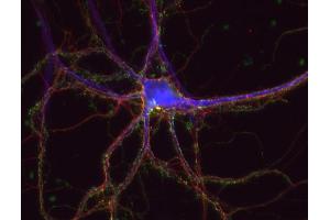 Immunocytochemistry (ICC) image for anti-tau Protein (AA 3-214) antibody (ABIN1742567) (tau Antikörper  (AA 3-214))