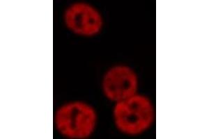 ABIN6276374 staining Hela cells by IF/ICC. (Retinoic Acid Receptor alpha Antikörper  (N-Term))