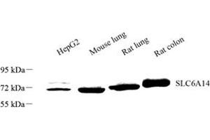 Western blot analysis of SLC6A14 (ABIN7075677) at dilution of 1: 1000 (Slc6a14 Antikörper)