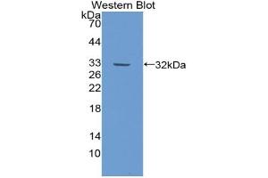 Western blot analysis of the recombinant protein. (ITIH2 Antikörper  (AA 452-702))