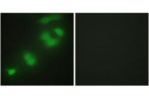 Immunofluorescence analysis of HepG2 cells, using CREBZF Antibody.
