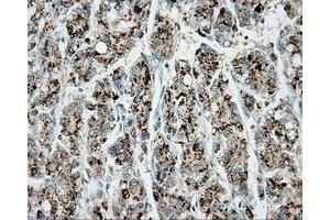 Immunohistochemical staining of paraffin-embedded pancreas tissue using anti-ERCC1 mouse monoclonal antibody. (ERCC1 Antikörper)