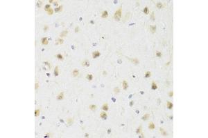 Immunohistochemistry of paraffin-embedded rat brain using PAWR Antibody (ABIN5971565) at dilution of 1/100 (40x lens). (PAWR Antikörper)