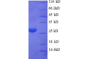 SDS-PAGE (SDS) image for SIVA1, Apoptosis-Inducing Factor (SIVA1) (AA 1-110) protein (His-SUMO Tag) (ABIN5710366) (SIVA1 Protein (AA 1-110) (His-SUMO Tag))