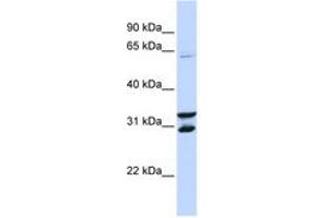 Image no. 1 for anti-F-Box Protein 24 (FBXO24) (AA 72-131) antibody (ABIN6743157) (FBXO24 Antikörper  (AA 72-131))