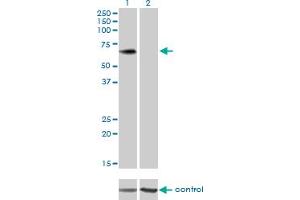Western blot analysis of PLXDC1 over-expressed 293 cell line, cotransfected with PLXDC1 Validated Chimera RNAi (Lane 2) or non-transfected control (Lane 1). (PLXDC1 Antikörper  (AA 313-421))