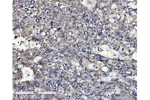 IHC analysis of P Glycoprotein/ABCB1 using anti-P Glycoprotein/ABCB1 antibody (ABIN7602262).