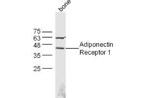 Mouse bone lysates probed with Adiponectin Receptor 1 Polyclonal Antibody, Unconjugated  at 1:300 dilution and 4˚C overnight incubation. (Adiponectin Receptor 1 Antikörper  (AA 241-270))