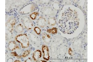 Immunoperoxidase of monoclonal antibody to TIMP2 on formalin-fixed paraffin-embedded human kidney. (TIMP2 Antikörper  (AA 27-220))
