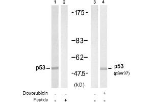 Image no. 1 for anti-Tumor Protein P53 (TP53) (Ser37) antibody (ABIN319308) (p53 Antikörper  (Ser37))