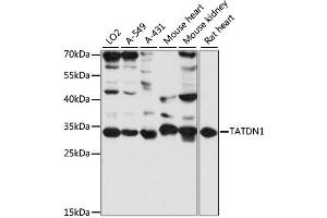 Western blot analysis of extracts of various cell lines, using TATDN1 antibody (ABIN6293775) at 1:3000 dilution. (TATDN1 Antikörper)