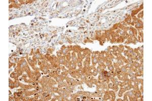 IHC-P Image Immunohistochemical analysis of paraffin-embedded human liver, using FDFT1, antibody at 1:100 dilution. (FDFT1 Antikörper)