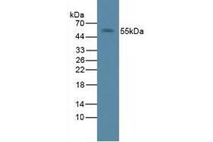 Detection of ErbB2 in Rat Liver Tissue using Polyclonal Antibody to Receptor Tyrosine Protein Kinase erbB-2 (ErbB2) (ErbB2/Her2 Antikörper  (AA 377-579))