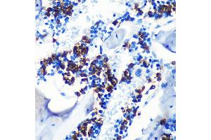 Immunohistochemistry of paraffin-embedded mouse bone marrow using S100 Rabbit mAb (ABIN7270128) at dilution of 1:100 (40x lens).